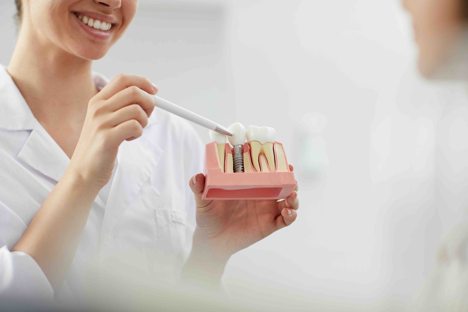 Dental implants in Horley