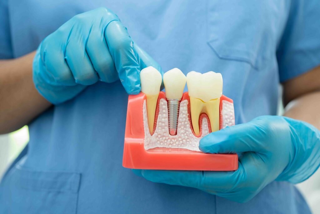 How osseointegration works