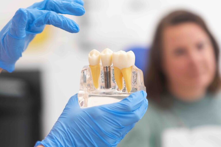 Can dental implants be done in one day
